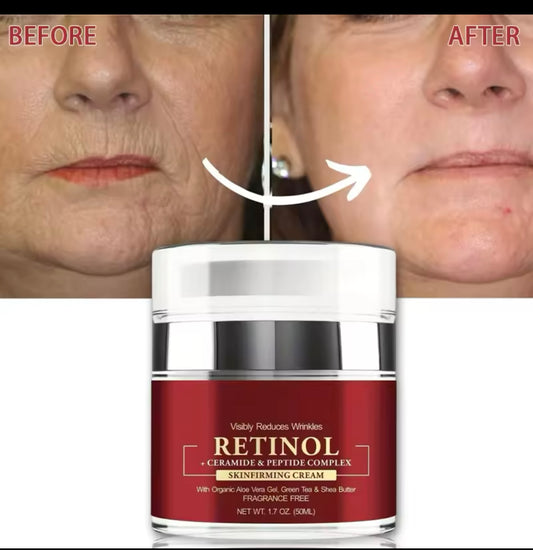Retinol cream wrinkle remover.